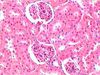 WholeKidney-400x-1.jpg