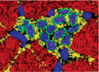 Filename=adultmyocyte.jpg
Filesize=15KiB
Dimensions=200x145
Date added=May 14, 2008 adultmyocyte.jpg