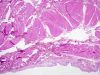 Filename=bladder1~0.jpg
Filesize=295KB
Dimensions=1360x1024
Date added=May 01, 2007 bladder1~0.jpg