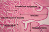 bladder1label.jpg