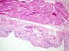 Filename=bladder2~0_new1.jpg
Filesize=295KB
Dimensions=1360x1024
Date added=May 01, 2007 bladder2~0_new1.jpg