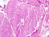 Filename=bladder3~0.jpg
Filesize=385KB
Dimensions=1360x1024
Date added=May 01, 2007 bladder3~0.jpg
