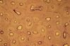 Filename=bone4.jpg
Filesize=53KiB
Dimensions=768x512
Date added=Mar 27, 2007 bone4.jpg