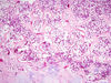 Filename=bone5~0.jpg
Filesize=376KiB
Dimensions=1360x1024
Date added=May 01, 2007 bone5~0.jpg