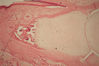Filename=bonedeveloping2.jpg
Filesize=250KiB
Dimensions=768x512
Date added=Mar 27, 2007 bonedeveloping2.jpg
