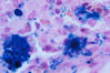 Filename=bonemarrow1.jpg
Filesize=24KiB
Dimensions=400x267
Date added=Sep 07, 2007 bonemarrow1.jpg