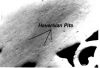 Filename=bone~0.jpg
Filesize=44KiB
Dimensions=644x440
Date added=Oct 05, 2008 bone~0.jpg