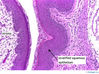 cervix20x.jpg