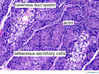 clitoralgland40x.jpg