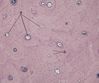 Filename=compact_bone_-_decalcified_cross_section.jpg
Filesize=90KiB
Dimensions=625x524
Date added=Apr 19, 2007 compact_bone_-_decalcified_cross_section.jpg