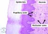 Filename=dermis1~1.jpg
Filesize=122KB
Dimensions=399x287
Date added=Jun 26, 2008 dermis1~1.jpg