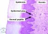 Filename=dermis2~0.jpg
Filesize=124KB
Dimensions=399x287
Date added=Jun 26, 2008 dermis2~0.jpg