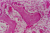 Filename=developing_membrane_bone.jpg
Filesize=768KiB
Dimensions=881x592
Date added=Apr 03, 2007 developing_membrane_bone.jpg
