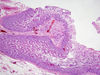 duodenum5.jpg