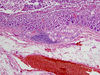 duodenum6.jpg