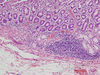 duodenum7.jpg