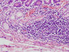 duodenum8.jpg