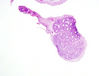 epididymis1.jpg