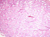 epididymis5.jpg