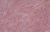 fibrocartilage3.jpg