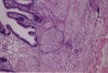 Filename=gallbladder.jpg
Filesize=712KiB
Dimensions=872x594
Date added=Aug 28, 2007 gallbladder.jpg