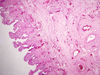 Filename=gallbladder1~0.jpg
Filesize=198KiB
Dimensions=1360x1024
Date added=May 07, 2007 gallbladder1~0.jpg