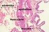 gallbladder2label.jpg