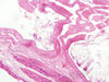 Filename=gallbladder8.jpg
Filesize=124KiB
Dimensions=1360x1024
Date added=May 07, 2007 gallbladder8.jpg