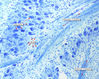 Filename=histology_brainstem_03_lb.jpg
Filesize=266KiB
Dimensions=1063x851
Date added=May 19, 2008 histology_brainstem_03_lb.jpg