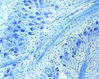 histology_brainstem_03_nl.jpg