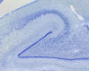 histology_hippocampus_02_nl.jpg