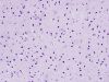 hyaline2~0.jpg