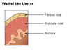 illu_ureters_wall.jpg