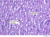 kidneymedulla40x.jpg