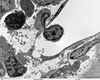 Filename=kneecap_marrow_79999-2_6.jpg
Filesize=518KiB
Dimensions=1560x1254
Date added=Aug 04, 2007 kneecap_marrow_79999-2_6.jpg