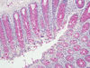 largeintestine7.jpg