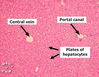 liver1F.jpg