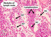 lymphnode4F.jpg