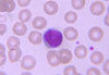 lymphocyte2.jpg