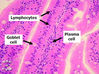 lymphoid1F.jpg