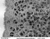 Filename=mouse_emb__brain_6_dcell2.jpg
Filesize=98KiB
Dimensions=640x505
Date added=Apr 14, 2007 mouse_emb__brain_6_dcell2.jpg