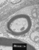 Filename=myelin.jpg
Filesize=119KiB
Dimensions=550x694
Date added=May 20, 2008 myelin.jpg