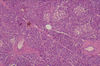 pancreas1.jpg