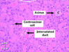 pancreas3F.jpg