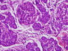 pancreas9.jpg