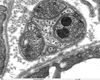 pancreas_cap__axon_80307.jpg