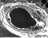 pancreas_cap__axon_80309.jpg