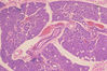 parotid2.jpg