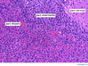 pituitarygland40x.jpg