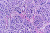 salivarygland1.jpg